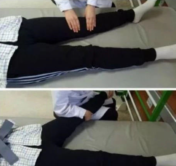 膝過伸不煩惱，康復(fù)訓(xùn)練有妙招